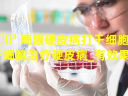 🌳 局限硬皮病打干细胞 🦋 （干细胞治疗硬皮病_有效果吗）